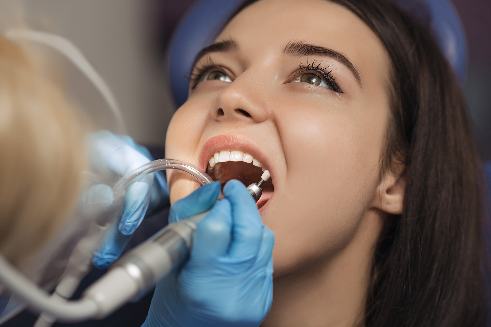 How Often Should You Get a Dental Cleaning? Understanding the Optimal Frequency