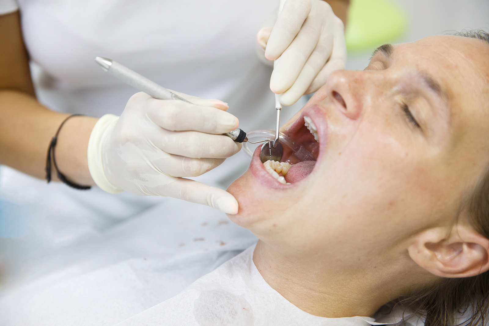 How to Speed Up Healing After a Tooth Extraction: Expert Advice